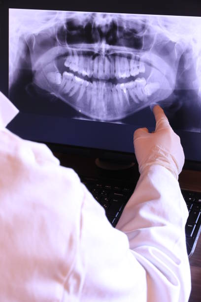 Best Emergency Treatment for Dental Infections or Abscesses in Othello, WA